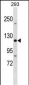 TJP3 Antibody (N-term)