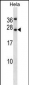 LEP Antibody (N-term)