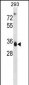 AKR1D1 Antibody (Center)