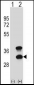 CD79B Antibody (Center)