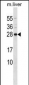 CD79B Antibody (Center)