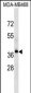 LPAR4 Antibody (Center)