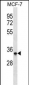 MAD2L1BP Antibody (N-term)