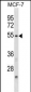 NFIL3 Antibody (N-term)