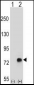 TGFBI Antibody (N-term)