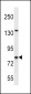 CPT1B Antibody (C-term)