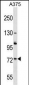 ACOX2 Antibody (N-term)