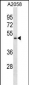 BFAR Antibody (N-term)