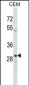 OR1D2 Antibody (C-term)