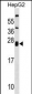 ZNRF1 Antibody (Center)