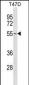 ERGIC2 Antibody (C-term)