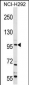 TRPC4 Antibody (C-term)