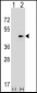 SEPT2 Antibody (C-term)