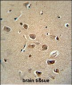 Rat Serpinh1 Antibody (Center)