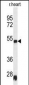 Rat Serpinh1 Antibody (Center)