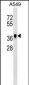 METAP1 Antibody