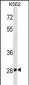 CD7 Antibody (N-term)