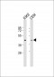 PDK4 Antibody