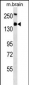 TSC1 Antibody