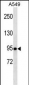 TLE1 Antibody (Center)