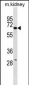 KCNJ3 Antibody (C-term)