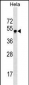 GBX2 Antibody (Center)