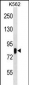 RPS6KA3 Antibody(Ascites)