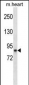 RPS6KA3 Antibody(Ascites)