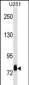 RPS6KA3 Antibody