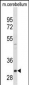 ZWINT Antibody(Ascites)