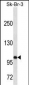 SPN/CD43 Antibody (N-term)(Ascites)