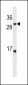 LTB Antibody (C-term)(Ascites)