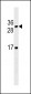 LTB Antibody (C-term)