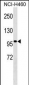 TLE4 Antibody (Center)