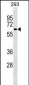 NCOA4 Antibody(Ascites)