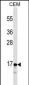 CALCA/CT Antibody