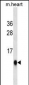 UBL5 Antibody(Ascites)