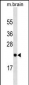RAB23 Antibody