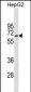 STK39 Antibody(Ascites)