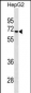 STK39 Antibody