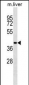 AHCY Antibody(Ascites)