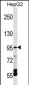 TRPV5 Antibody (C-term)