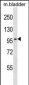 TOP3B Antibody (C-term)