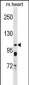 KCNQ5 Antibody (C-term)