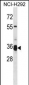 TMPRSS12 Antibody (N-term)