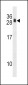 RCAN1 Antibody (N-term)