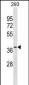 GGPS1 Antibody (Center)