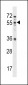 MEX3B Antibody (N-term)