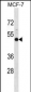 NMBR Antibody (N-term)