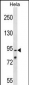 OSBPL1A Antibody (C-term)